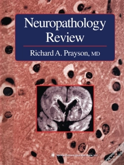 Capa do artigo Neuropathology Review