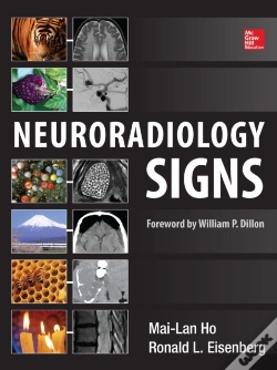 Capa do artigo Neuroradiology Signs