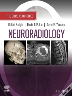 Capa do artigo Neuroradiology: The Requisites E-Book