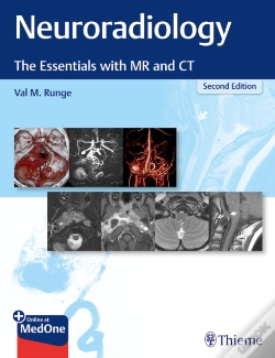 Capa do artigo Neuroradiology