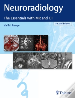 Capa do artigo Neuroradiology