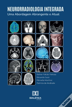 Capa do artigo Neurorradiologia Integrada