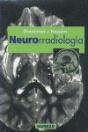 Neurorradiologia - Preview