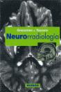Neurorradiologia - Preview