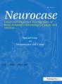 Neuroscience And Crime - Preview