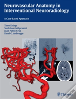 Capa do artigo Neurovascular Anatomy In Interventional Neuroradiology