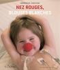 Nez Rouges, Blouses Blanches - Preview