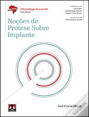 Noções de Prótese sobre Implante