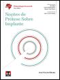 Noções de Prótese sobre Implante - Preview
