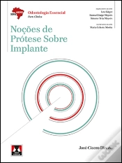 Capa do artigo Noções de Prótese sobre Implante