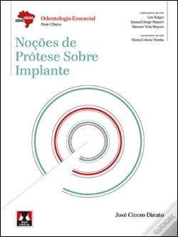 Capa do artigo Noções de Prótese sobre Implante