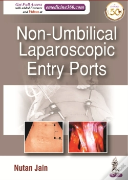 Capa do artigo Non-Umbilical Laparoscopic Entry Ports