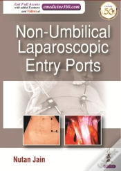 Capa do artigo Non-Umbilical Laparoscopic Entry Ports