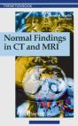 Normal Findings In Ct And Mri, A1, Print - Preview