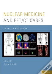 Capa do artigo Nuclear Medicine And Pet/Ct Cases