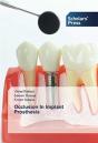 Occlusion In Implant Prosthesis - Preview