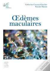 Oedèmes Maculaires