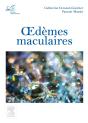 Oedèmes Maculaires - Preview