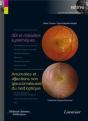 Oeil Et Maladies Systémiques ; Anomalies Et Affections Non Glaucomateuses Du Nerf Optique - Preview