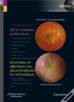 Capa do artigo Oeil Et Maladies Systémiques ; Anomalies Et Affections Non Glaucomateuses Du Nerf Optique