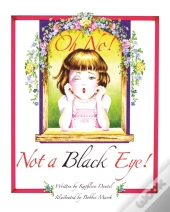 Oh No! Not A Black Eye!