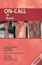 On-Call In Burns