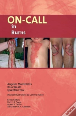 Capa do artigo On-Call In Burns