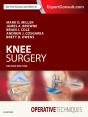 Operative Techniques: Knee Surgery E-Book - Preview