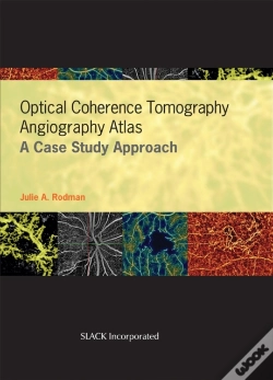 Capa do artigo Optical Coherence Tomography Angiography Atlas