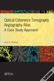 Capa do artigo Optical Coherence Tomography Angiography Atlas