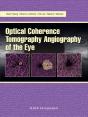 Optical Coherence Tomography Angiography Of The Eye - Preview