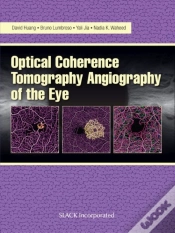 Capa do artigo Optical Coherence Tomography Angiography Of The Eye