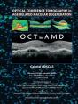 Optical Coherence Tomography In Age-Related Macular Degeneration - Preview