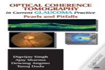 Optical Coherence Tomography In Current Glaucoma Practice