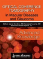 Optical Coherence Tomography In Macular Diseases And Glaucoma: Advanced Knowledge - Preview