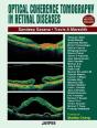 Optical Coherence Tomography In Retinal Diseases - Preview
