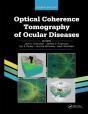 Optical Coherence Tomography Of Ocular Diseases - Preview