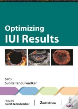 Capa do artigo Optimizing Iui Results
