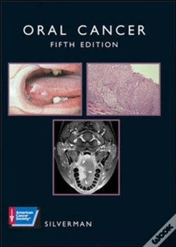 Capa do artigo Oral Cancer