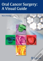 Capa do artigo Oral Cancer Surgery