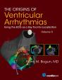 Origins Of Ventricular Arrhythmias: Using The Ecg As A Key Tool For Localization, Volume 3 - Preview