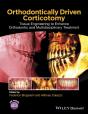 Orthodontically Driven Corticotomy - Preview