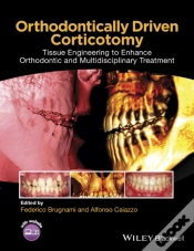 Capa do artigo Orthodontically Driven Corticotomy