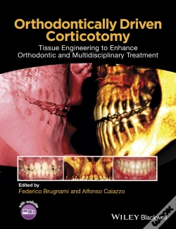 Capa do artigo Orthodontically Driven Corticotomy