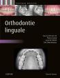 Orthodontie Linguale - Preview