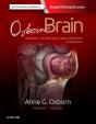 Osborn'S Brain - Preview