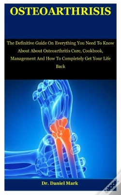 Capa do artigo Osteoarthritis