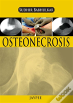 Osteonecrosis