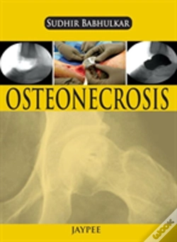 Capa do artigo Osteonecrosis