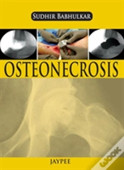 Capa do artigo Osteonecrosis